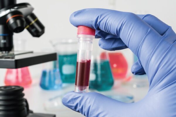 Blood Borne Testing Market Is Set To Witness Exponential Growth with Over 7%-8% CAGR during 2021-2031