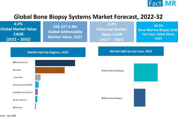 Growing Patient Population Is Accelerating The Growth Of The Bone Biopsy Systems Market